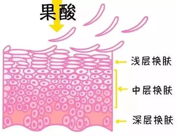 “刷酸”护肤，美丽不打烊